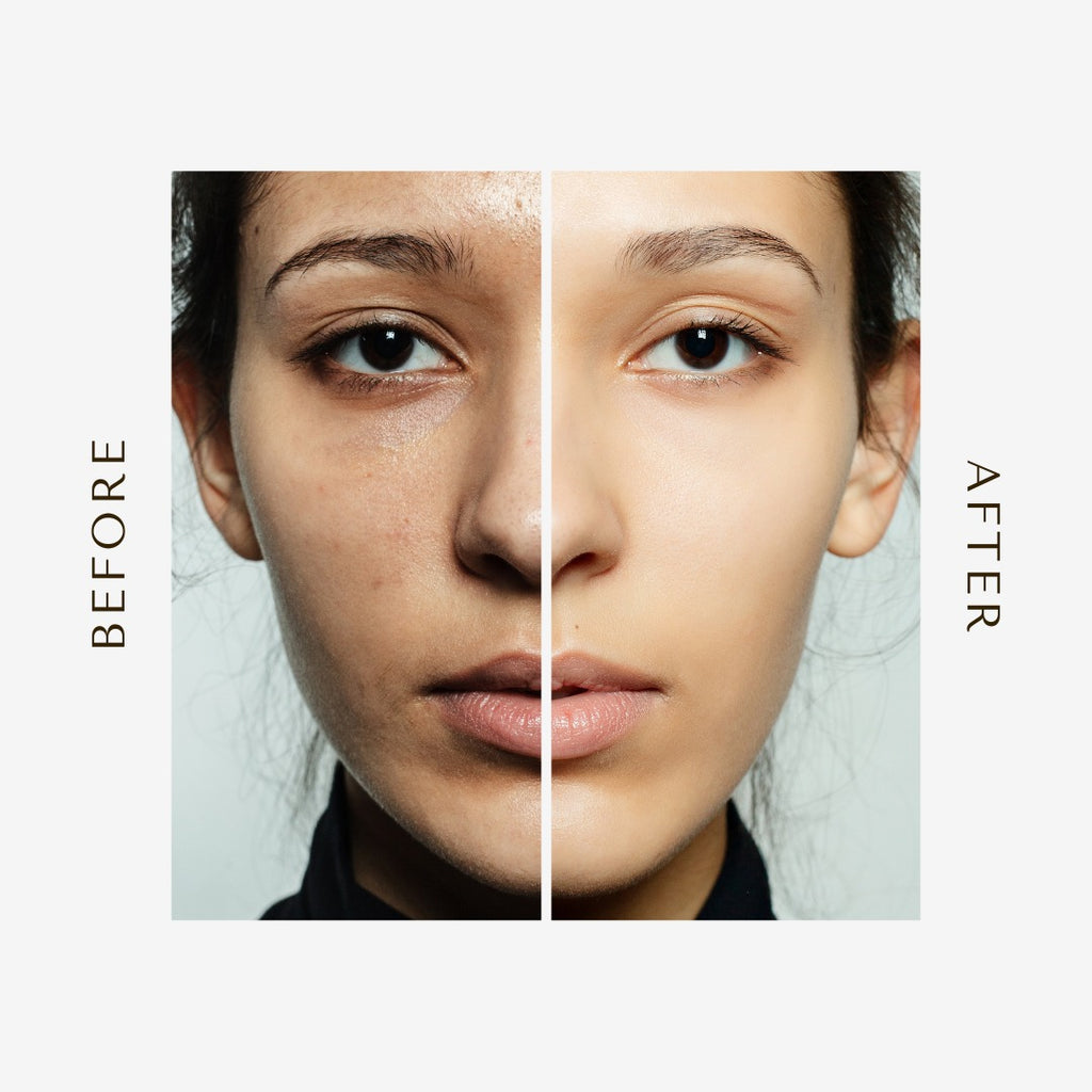 Bundle Of 3 The Ordinary Glycolic Acid