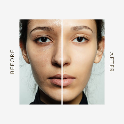 Bundle Of 3 The Ordinary Glycolic Acid